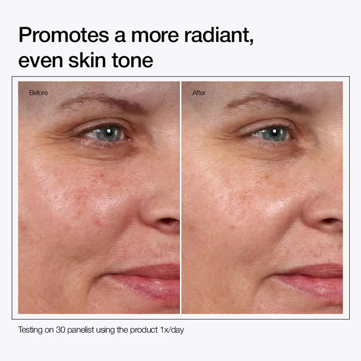 Glycolic Acid 7% Toning Solution (Buy 1 Get 1 Free)