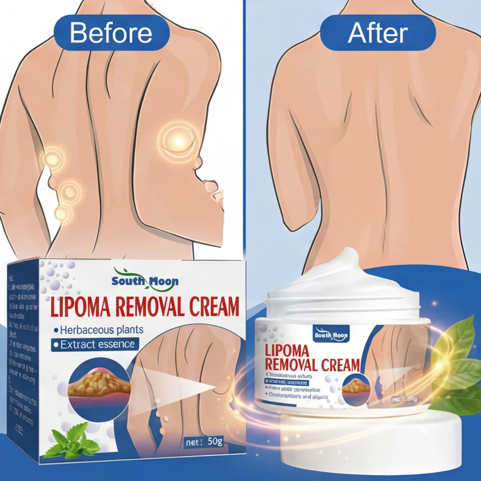 Lipoma Removal Cream